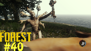 THE FOREST [HD] [0.03] #40 - Frische Körperteile ☼ Let's Play The Forest