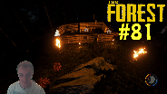 THE FOREST [HD] [FACECAM] [0.06B] #81 - Anbau für die Gärten ☼ Let's Play The Forest